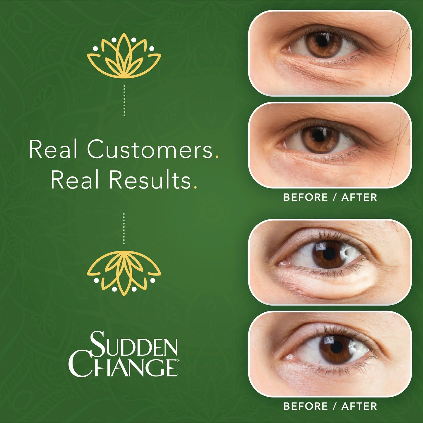 Sudden Change Instant Under-Eye Firming Serum - Under-Eye Bags Treatment for Puffiness, Lines, & Wrinkles - 3 Minute Results (0.23 oz)